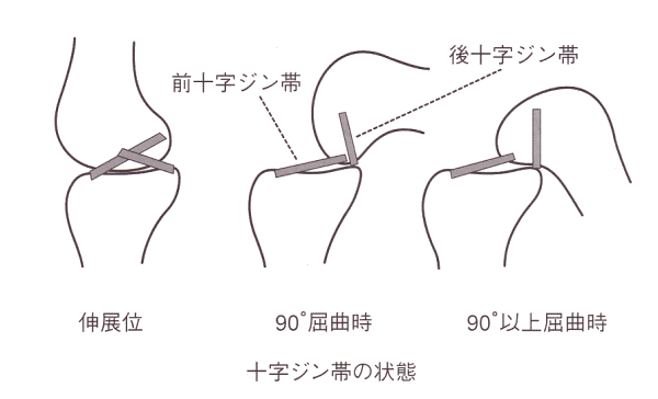 十字靭帯の屈曲伸展